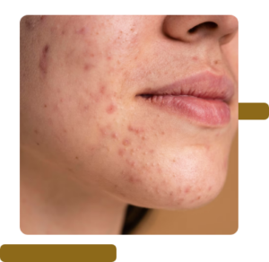 Tratamento Dermatologia Clínica